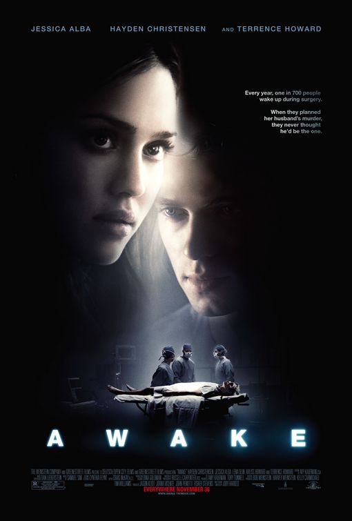 Awake / ნარკოზი